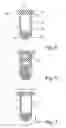 Fig. 06 - RESPIRATORY MASK ASSEMBLY FOR STABILIZING PATIENT INTERFACE