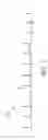 Fig. 04 - Method and system of utilizing ECG signal for central venous catheter tip positioning