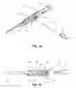Fig. 06 - Catheter insertion device