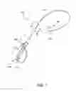 Fig. 02 - Torqueable steerable sheaths
