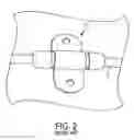 Fig. 03 - METHODS AND APPARATUS FOR SECURING A MEDICAL CLAMP TO A PATIENT