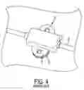 Fig. 05 - METHODS AND APPARATUS FOR SECURING A MEDICAL CLAMP TO A PATIENT