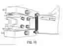 Fig. 15 - METHODS AND APPARATUS FOR SECURING A MEDICAL CLAMP TO A PATIENT