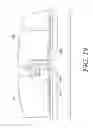 Fig. 21 - CATHETER ANCHORING DEVICE AND METHOD