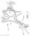 Fig. 02 - INTRAVASCULAR GUIDEWIRE