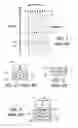 Fig. 02 - Cochlear implants having MRI-compatible magnet apparatus and associated methods