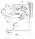 Fig. 02 - DIRECTIONAL ELECTRICAL STIMULATION LEADS AND SYSTEMS WITH ANCHORING UNITS AND METHODS OF MAKING AND USING