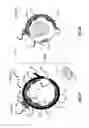 Fig. 02 - Systems and methods for assessing pelvic floor disorder therapy