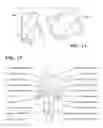 Fig. 09 - Topical neurological stimulation