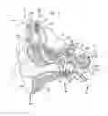 Fig. 02 - Shifting of output in a sense prosthesis