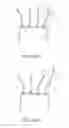 Fig. 20 - Gas inflatable balloons