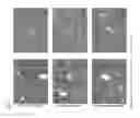 Fig. 07 - GEMCABENE, PHARMACEUTICALLY ACCEPTABLE SALTS THEREOF, COMPOSITIONS THEREOF AND METHODS OF USE THEREFOR