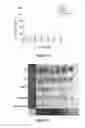 Fig. 20 - Type polypeptide targeting tumours