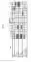 Fig. 16 - Neutralizing antibodies to gp120 and their use