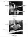 Fig. 22 - Acoustic perfusion devices