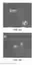 Fig. 07 - Microfluidic model of the blood brain barrier