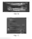 Fig. 11 - Microfluidic model of the blood brain barrier