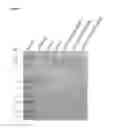 Fig. 02 - Cationic neurotoxins