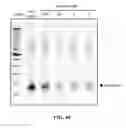 Fig. 50 - CRISPR effector system based diagnostics
