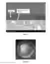 Fig. 04 - Fully Dense, Fluid Tight and Low Friction Coating Systems for Dynamically Engaging Load Bearing Surfaces for High Pressure High Temperature Applications