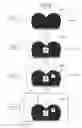 Fig. 09 - Non-transitory computer-readable medium storing sewing data generation program, sewing data generation device and sewing method