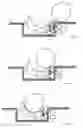 Fig. 02 - Traffic calming device