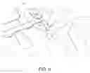 Fig. 06 - Portable windscreen