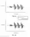 Fig. 17 - Door lock detection systems and methods