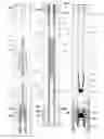 Fig. 01 - Subsurface reciprocating pump for gassy and sandy fluids