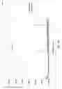 Fig. 05 - Bearing fault detection for surface pumping units