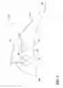 Fig. 07 - ENGINE COMPONENT WITH REPLACEABLE TIP ELEMENT