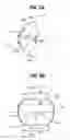 Fig. 07 - Ball joint