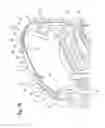 Fig. 15 - Disc brake and set of brake pads