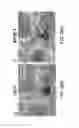 Fig. 40 - METHODS AND APPARATUS FOR SPECKLE-FREE OPTICAL COHERENCE IMAGING