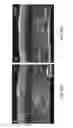 Fig. 43 - METHODS AND APPARATUS FOR SPECKLE-FREE OPTICAL COHERENCE IMAGING
