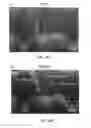 Fig. 50 - METHODS AND APPARATUS FOR SPECKLE-FREE OPTICAL COHERENCE IMAGING