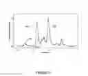 Fig. 04 - Method and apparatus to measure electrophoretic mobility of a flowing sample