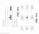Fig. 35 - Apparatus for detecting tumor cells