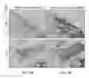 Fig. 04 - CERVICAL CANCER TESTING METHOD AND TEST REAGENT USED THEREFOR