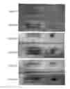 Fig. 08 - Methods and materials for identifying therapeutic response in chronic myeloid leukemia