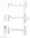 Fig. 07 - Image lens assembly and image capturing device