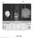 Fig. 05 - SYSTEMS AND METHODS OF OPTICAL COHERENCE TOMOGRAPHY STEREOSCOPIC IMAGING FOR IMPROVED MICROSURGERY VISUALIZATION