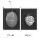 Fig. 06 - SYSTEMS AND METHODS OF OPTICAL COHERENCE TOMOGRAPHY STEREOSCOPIC IMAGING FOR IMPROVED MICROSURGERY VISUALIZATION