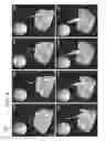Fig. 07 - SYSTEMS AND METHODS OF OPTICAL COHERENCE TOMOGRAPHY STEREOSCOPIC IMAGING FOR IMPROVED MICROSURGERY VISUALIZATION