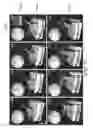 Fig. 08 - SYSTEMS AND METHODS OF OPTICAL COHERENCE TOMOGRAPHY STEREOSCOPIC IMAGING FOR IMPROVED MICROSURGERY VISUALIZATION
