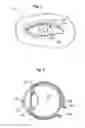 Fig. 02 - Method and system of creating an optimized lens for an eye
