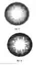 Fig. 05 - Colored contact lenses and method of making the same