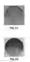 Fig. 19 - Method of making an optical article with an inkjet printing device