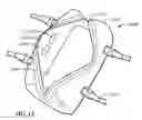 Fig. 22 - Interactive skin for wearable