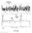 Fig. 87 - Machine communication system using haptic symbol set